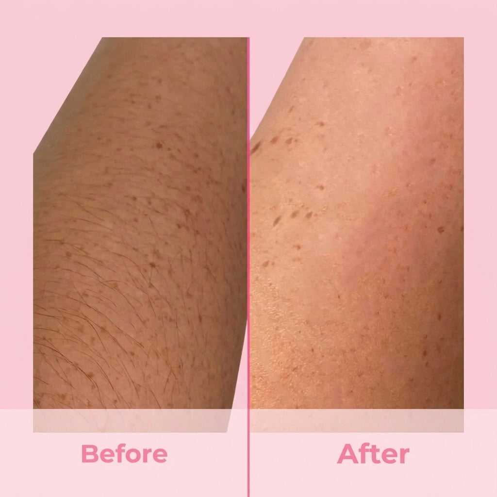SilkSkin Pro IPL Hair Removal