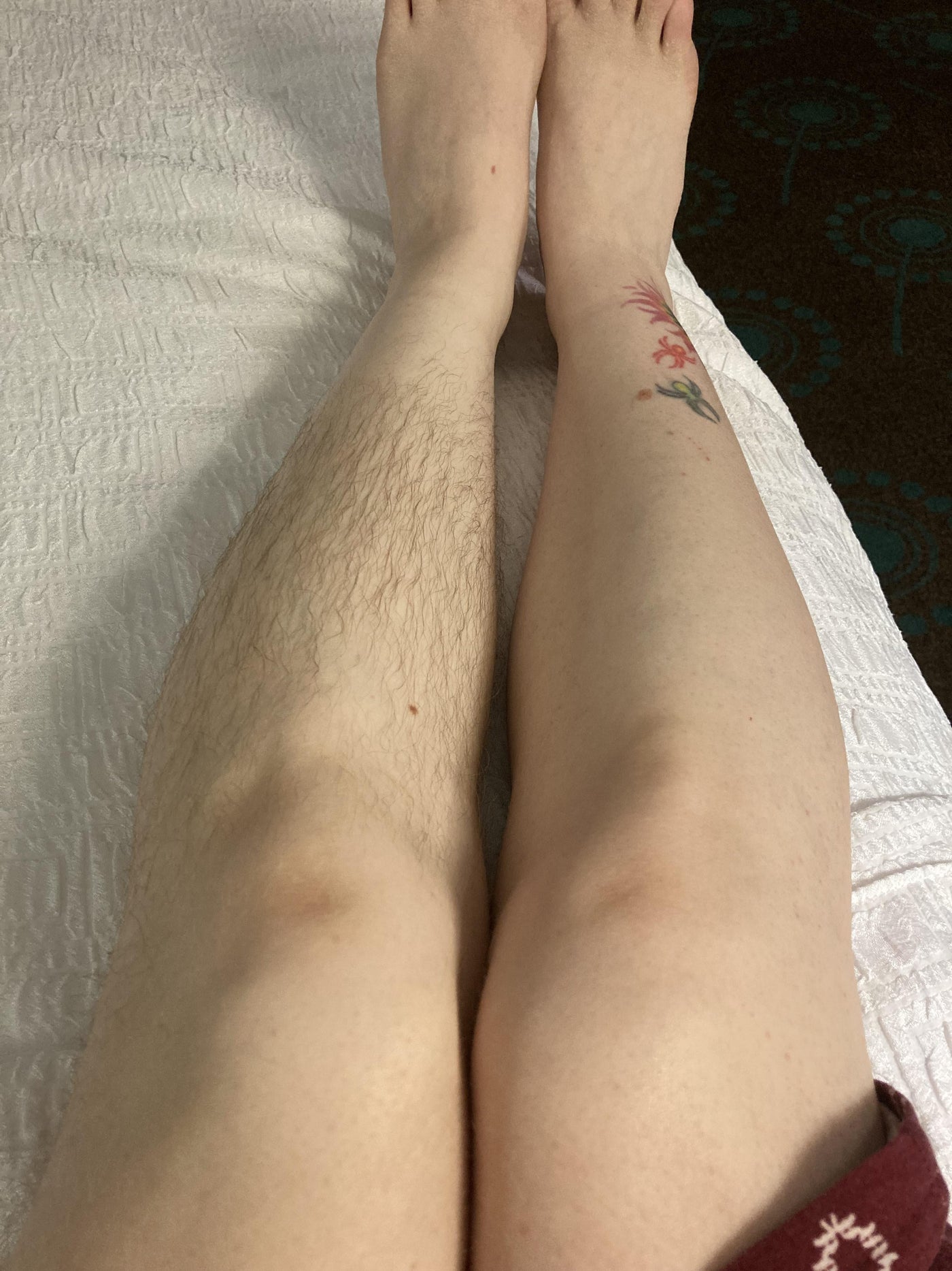 Before & After Results