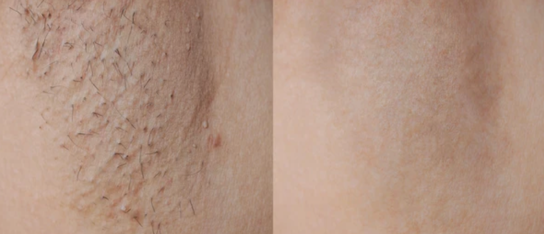 Before & After Results