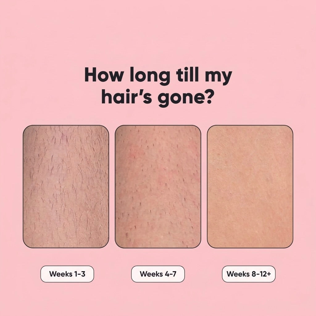 SilkSkin Pro IPL Hair Removal